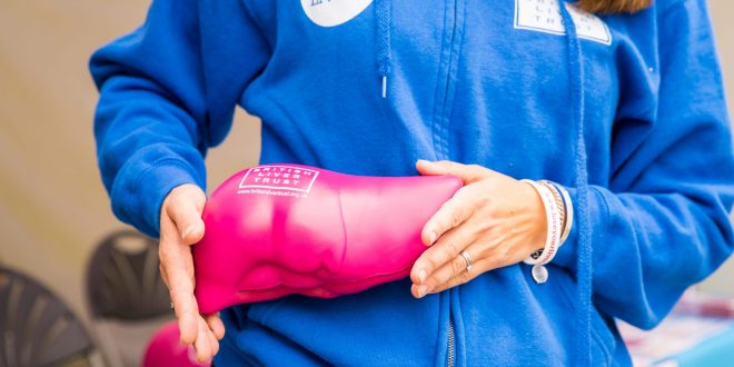 liver disease, liver health, liver charity, health, healthcare, liver, love your liver, hepatitis, cirrhosis, nafld, alcohol, obesity, alcohol-related liver disease, fatty liver disease