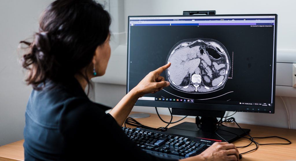 A woman in a dark top is seen from behind sitting in front of a computer monitor. The monitor shows an image from a CT scan. The women is pointing to the part of the image that shows the liver.