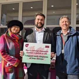L-R Pamela Healy OBE (CEO of British Liver Trust), Luke Fletcher MS, Dr Andrew Yeoman