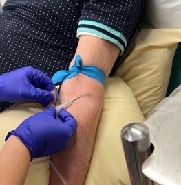 A close up picture of someone having venesection, showing their left arm. There is a tourniquet above their elbow and a nurse wearing gloves it inserting a needle linked to a tube into their elbow crease.