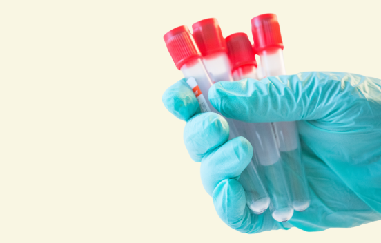 A hand in a blue medical glove holds 4 blood test tubes. They have red lids and are partially filled with clear liquid.
