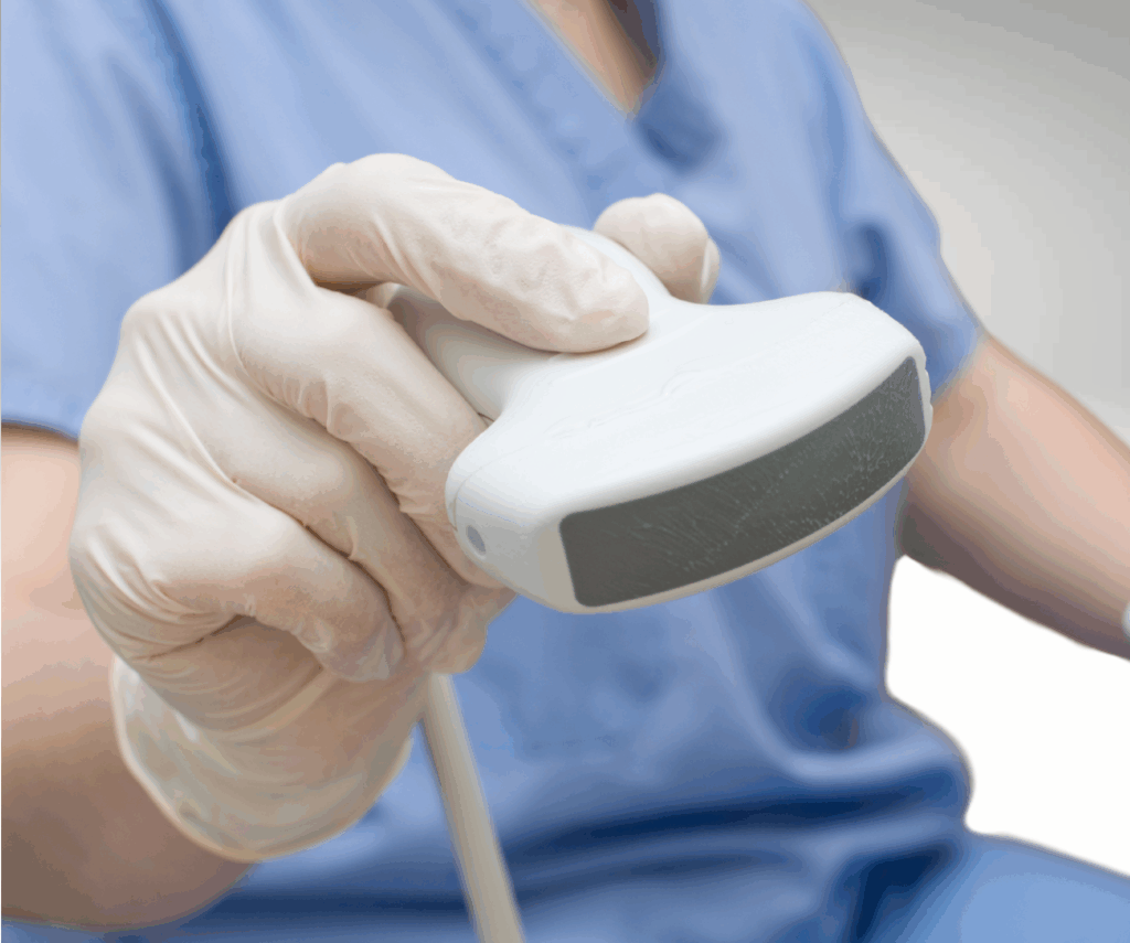 The image shows an ultrasound probe. It is a T shape and about the size of a hand. It is mostly white, but has a grey strip along the top of the T. The probe is held by someone in wearing a medical glove and blue surgical scribs.
